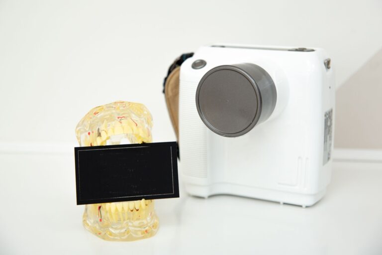 Close-up of a dental model and instant camera on a white surface, showcasing technology and healthcare.