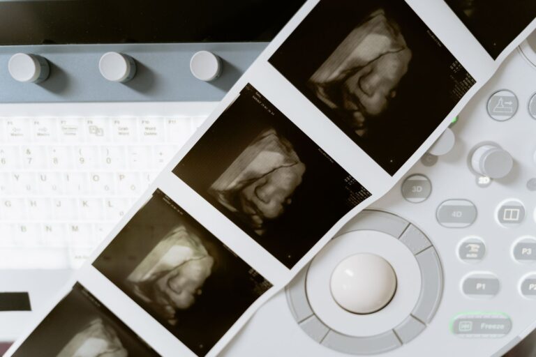 Close-up of a 3D ultrasound scan printout and medical equipment in a health lab.
