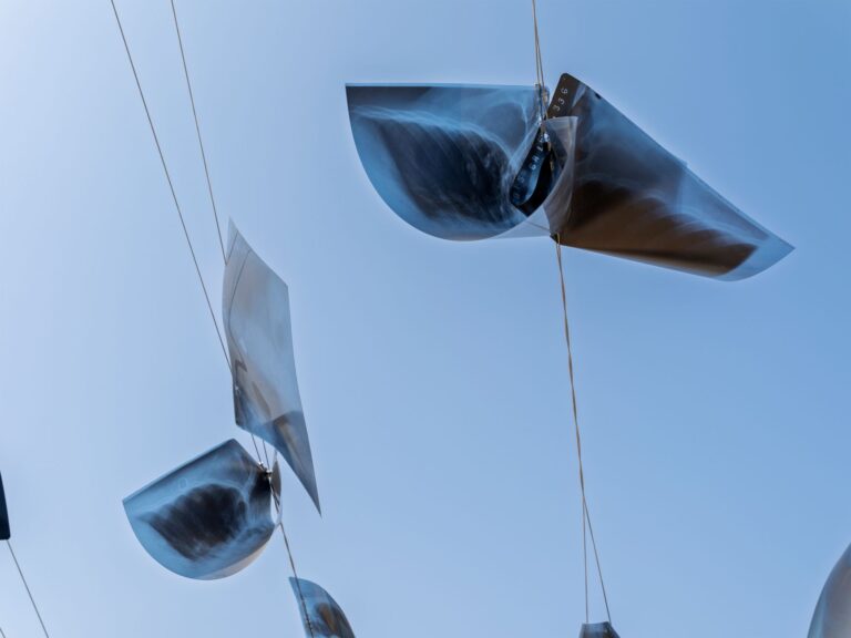 Unique installation of x-ray images suspended against a clear blue sky.