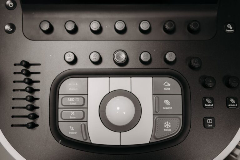 Detailed view of buttons and controls on a medical ultrasound machine for diagnostics.
